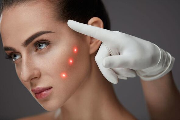 Facial laser rejuvenation