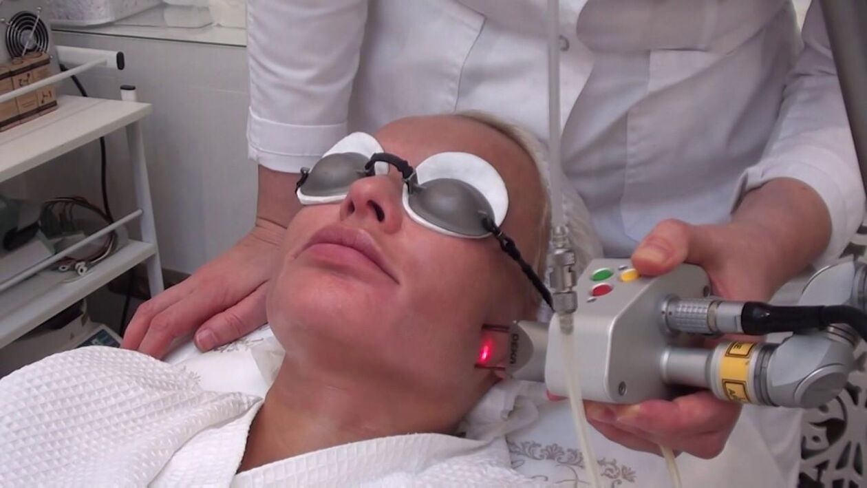 Laser beam treatment of problem areas of facial skin