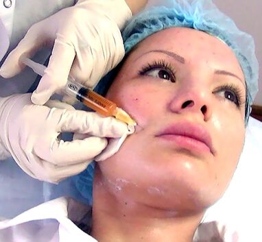 Treatment of plasma skin rejuvenation