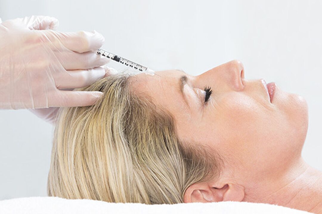 Plasmolifting is an injection method of facial skin rejuvenation